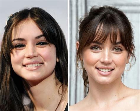 ana de armas mr skin|Ana de Armas Before and After Plastic Surgery: Nose, Boob